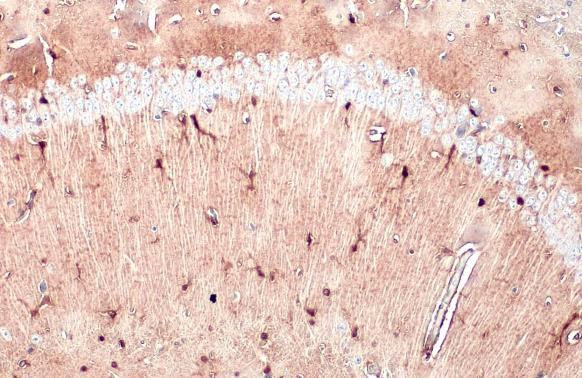 S100B Antibody in Immunohistochemistry (Paraffin) (IHC (P))