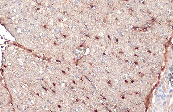 S100B Antibody in Immunohistochemistry (Paraffin) (IHC (P))