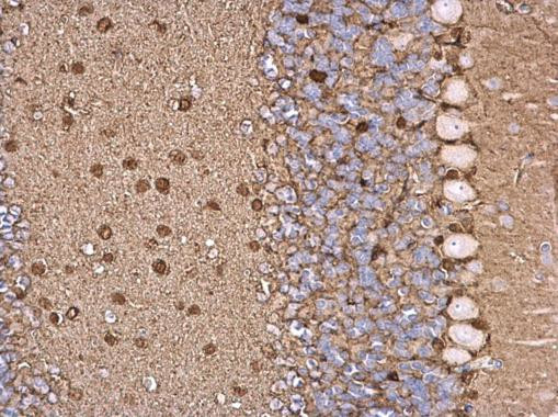 S100B Antibody in Immunohistochemistry (Paraffin) (IHC (P))