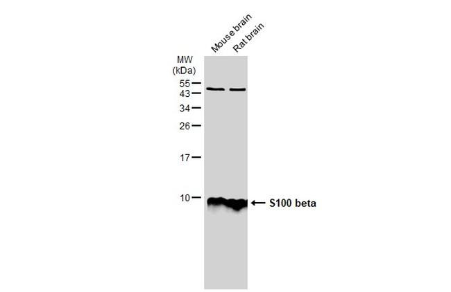 S100B Antibody in Western Blot (WB)