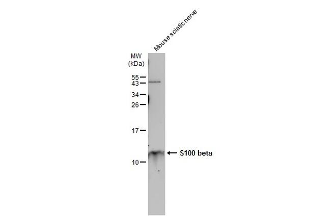 S100B Antibody in Western Blot (WB)