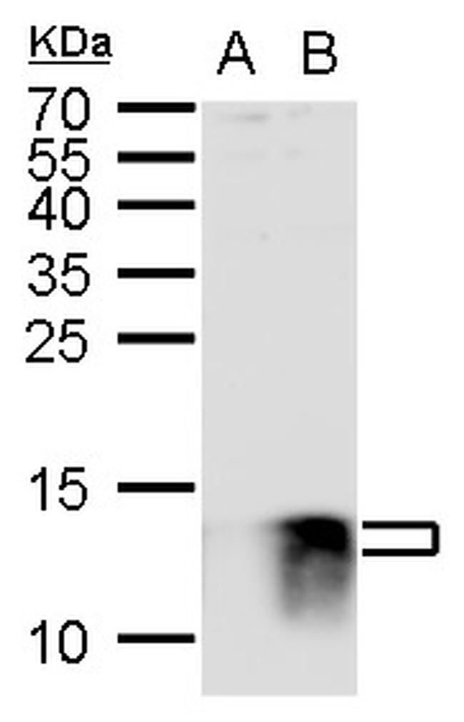 S100B Antibody in Western Blot (WB)