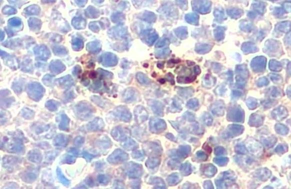 P-Selectin Antibody in Immunohistochemistry (Paraffin) (IHC (P))