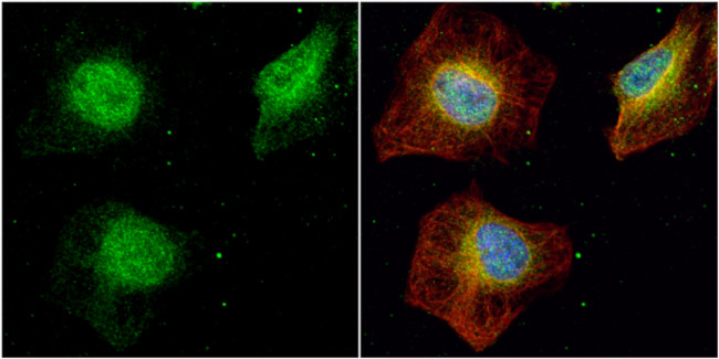 SET Antibody in Immunocytochemistry (ICC/IF)