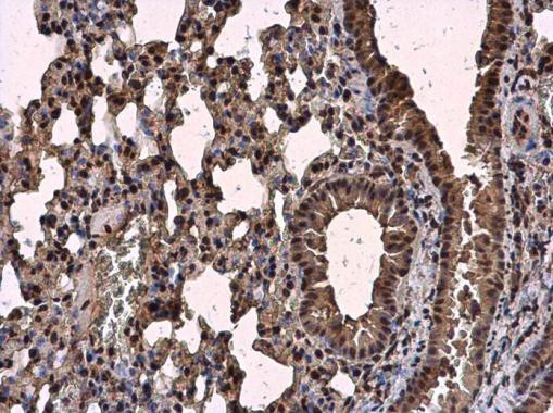 SRSF2 Antibody in Immunohistochemistry (Paraffin) (IHC (P))