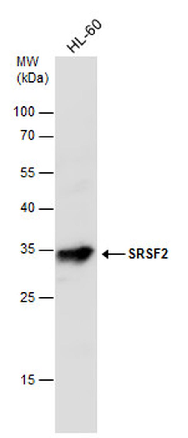 SRSF2 Antibody in Western Blot (WB)