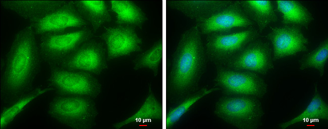 SH3GL1 Antibody in Immunocytochemistry (ICC/IF)