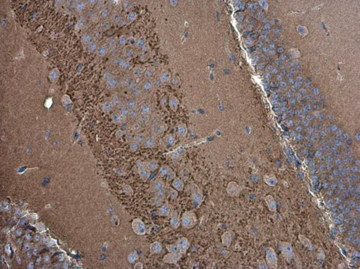 SH3GL1 Antibody in Immunohistochemistry (Paraffin) (IHC (P))