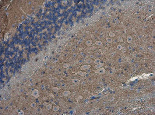 SH3GL1 Antibody in Immunohistochemistry (Paraffin) (IHC (P))