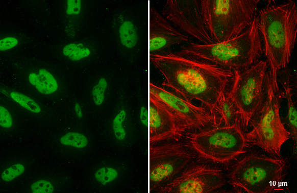 SMARCA2 Antibody in Immunocytochemistry (ICC/IF)