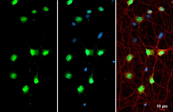 SMARCA2 Antibody in Immunocytochemistry (ICC/IF)