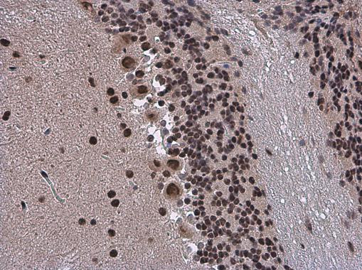 SMARCA2 Antibody in Immunohistochemistry (Paraffin) (IHC (P))