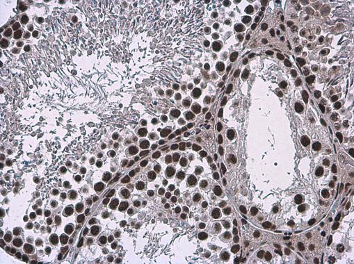 SMARCA2 Antibody in Immunohistochemistry (Paraffin) (IHC (P))