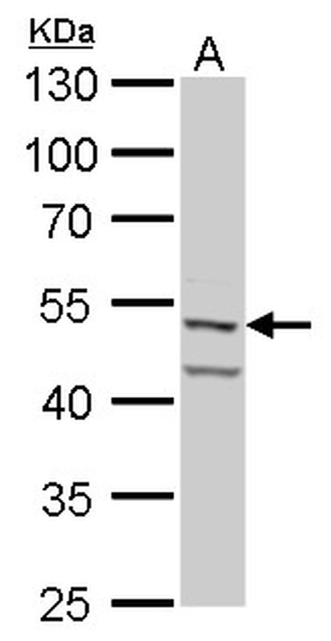 Fascin Antibody in Western Blot (WB)