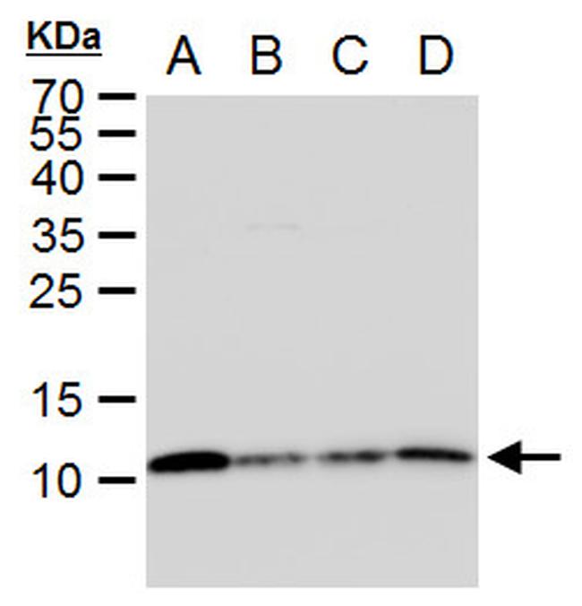 SNRPE Antibody in Western Blot (WB)