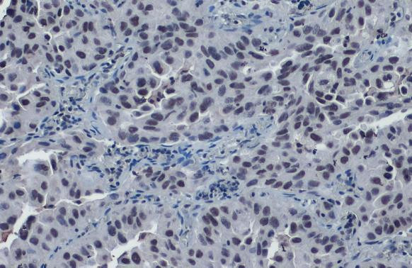 SP3 Antibody in Immunohistochemistry (Paraffin) (IHC (P))