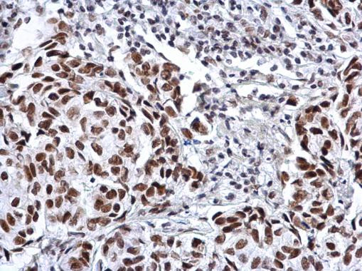 SP3 Antibody in Immunohistochemistry (Paraffin) (IHC (P))