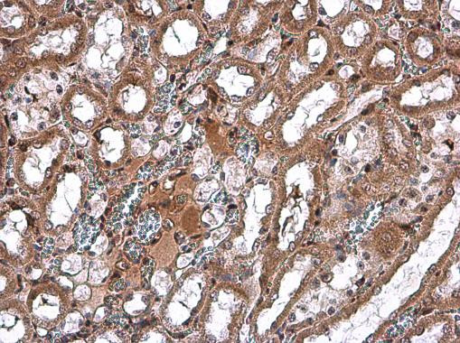 SPARC Antibody in Immunohistochemistry (Paraffin) (IHC (P))