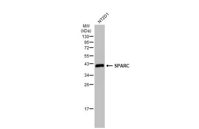 SPARC Antibody in Western Blot (WB)