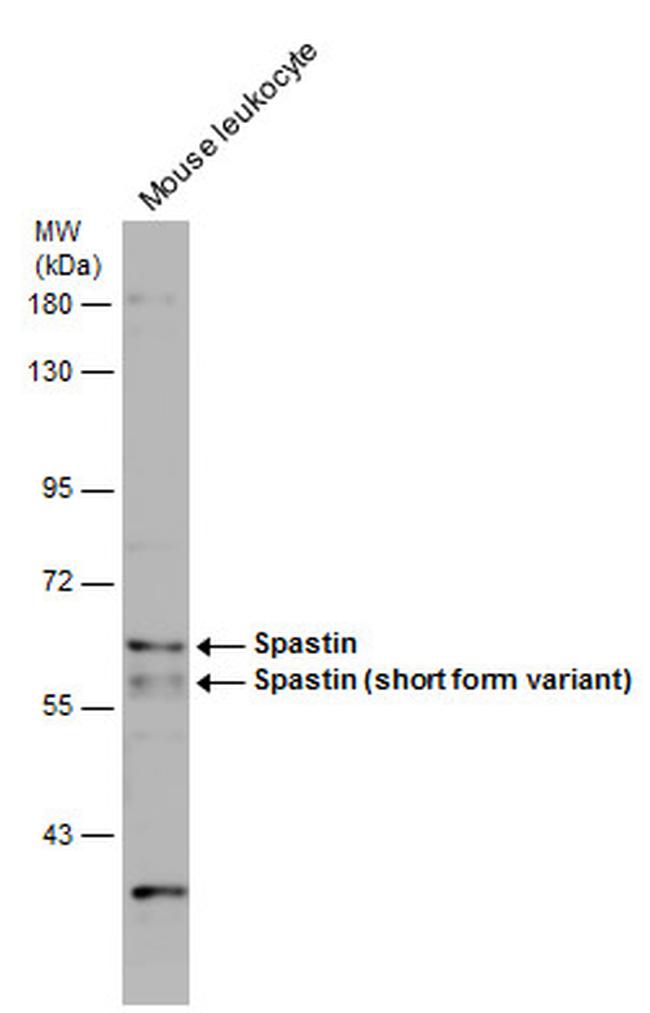 Spastin Antibody in Western Blot (WB)