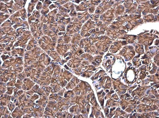 SPTBN1 Antibody in Immunohistochemistry (Paraffin) (IHC (P))