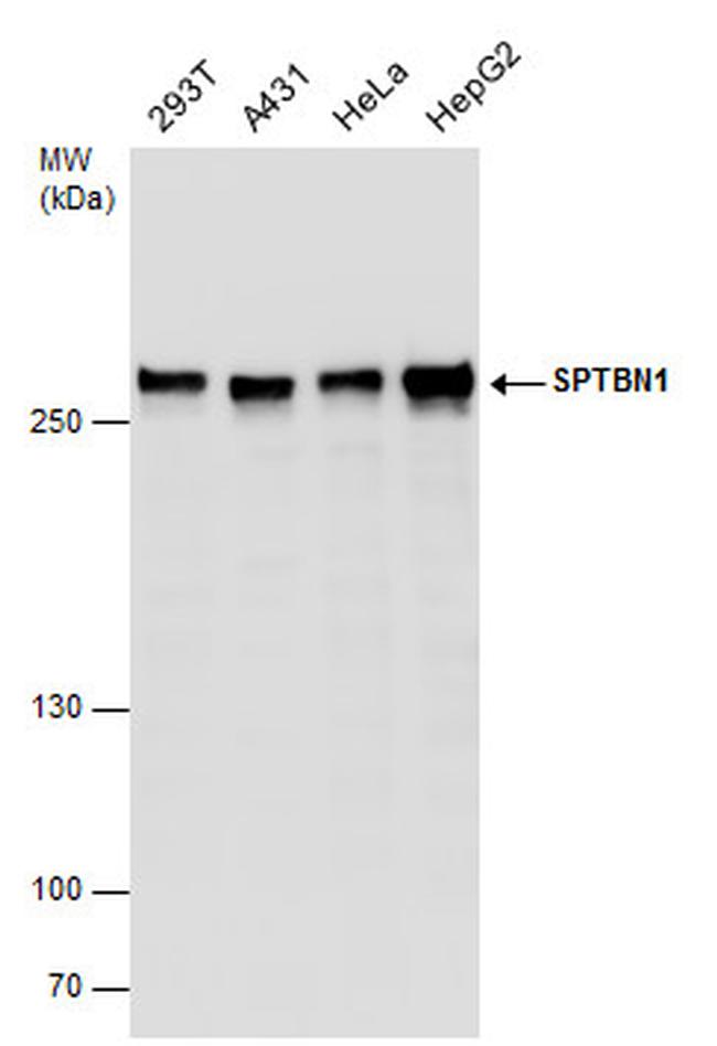 SPTBN1 Antibody in Western Blot (WB)