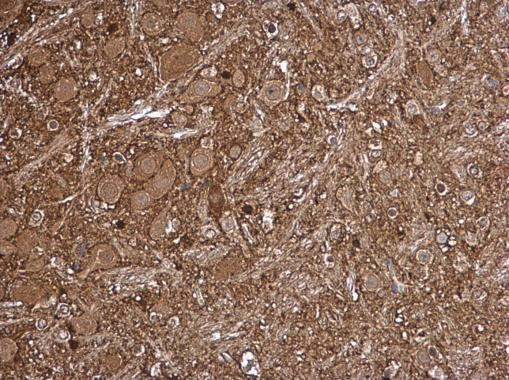 LKB1 Antibody in Immunohistochemistry (Paraffin) (IHC (P))