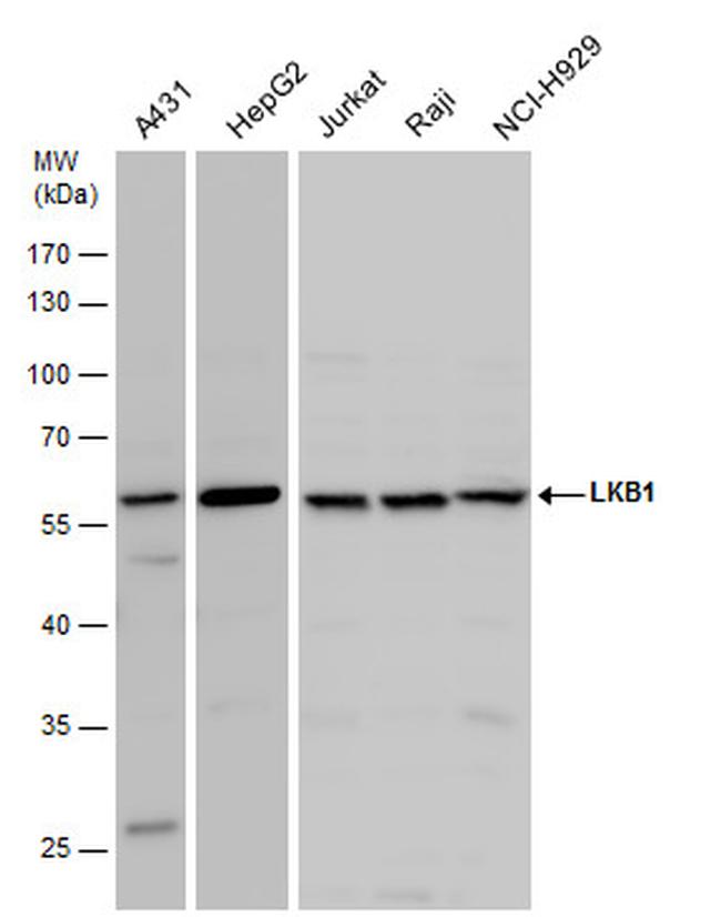 LKB1 Antibody in Western Blot (WB)