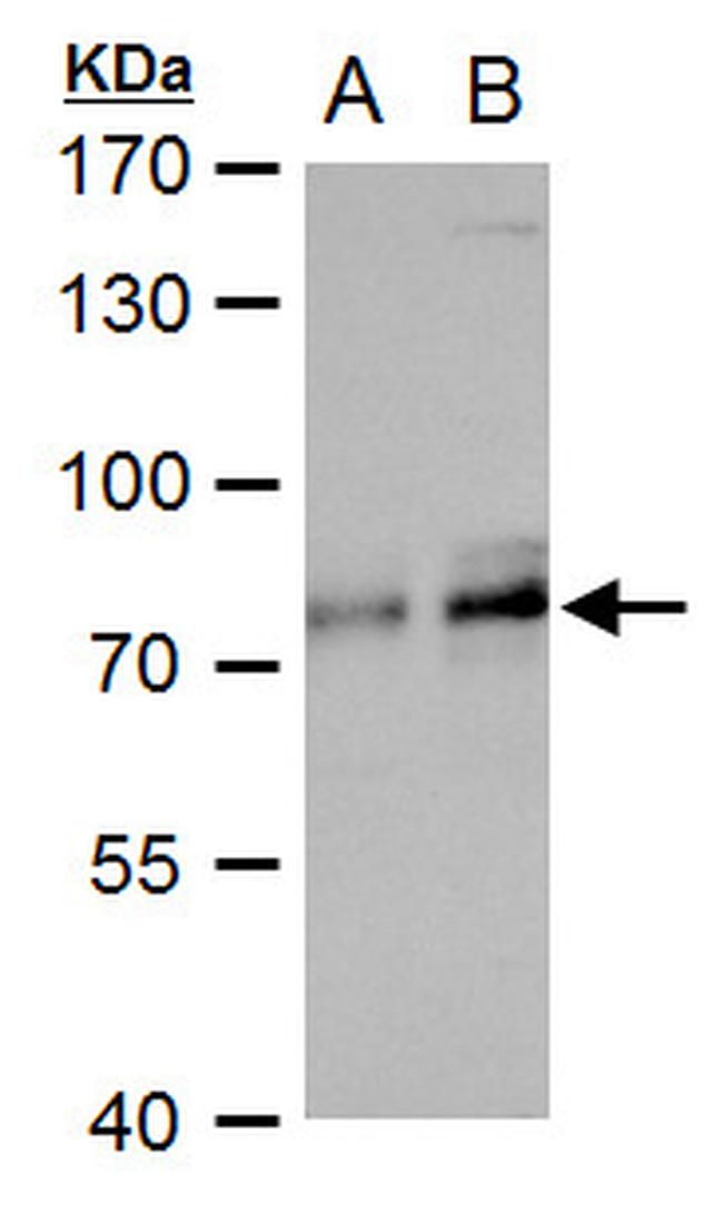 TCF3 Antibody in Western Blot (WB)