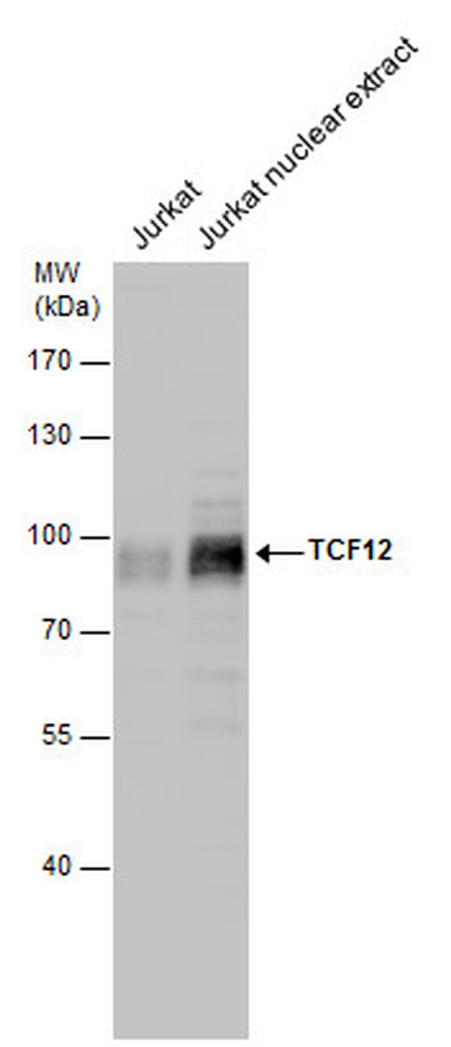 TCF12 Antibody in Western Blot (WB)