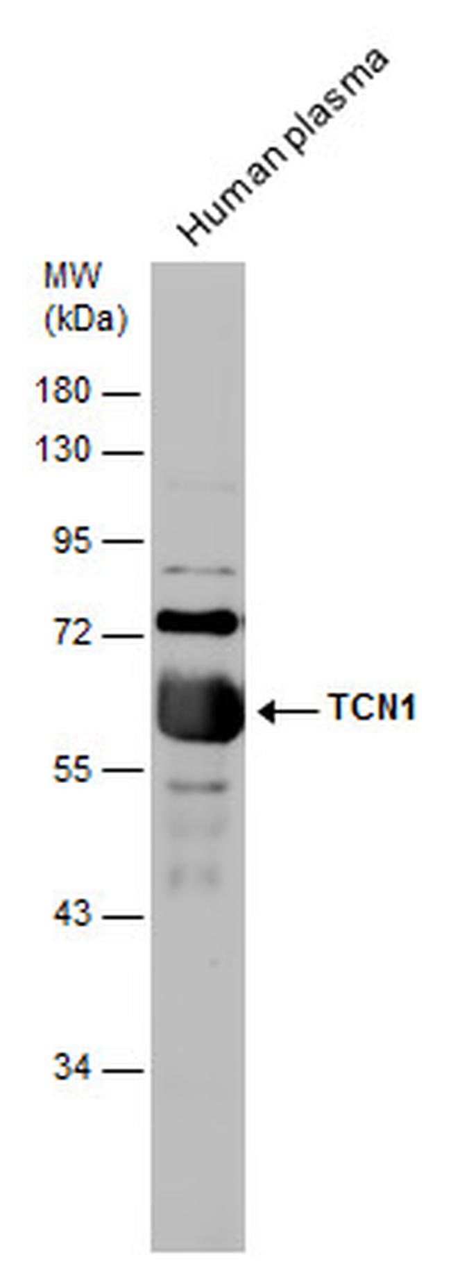 TCN1 Antibody in Western Blot (WB)