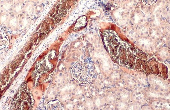 TGF beta-3 Antibody in Immunohistochemistry (Paraffin) (IHC (P))