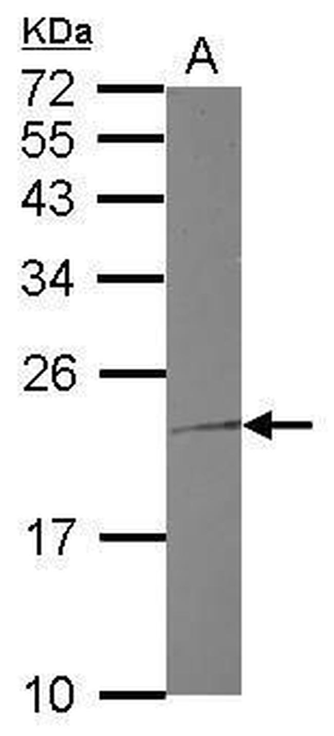 Troponin I Antibody in Western Blot (WB)