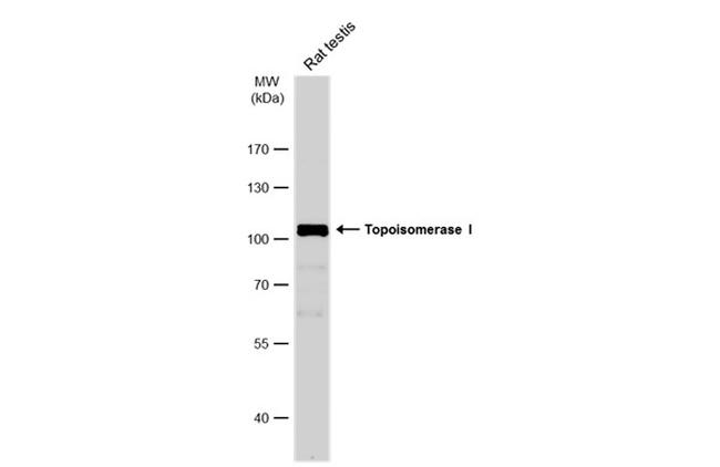 TOP1 Antibody in Western Blot (WB)