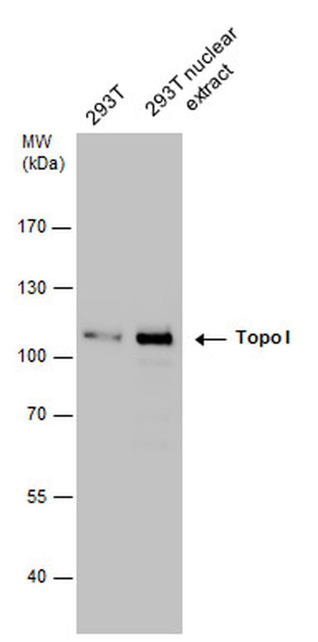 TOP1 Antibody in Western Blot (WB)