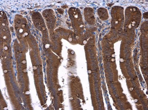 TSC1 Antibody in Immunohistochemistry (Paraffin) (IHC (P))