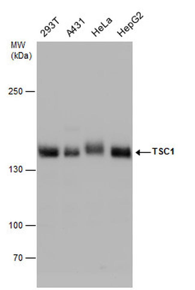 TSC1 Antibody in Western Blot (WB)