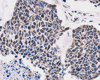 TTF1 Antibody in Immunohistochemistry (Paraffin) (IHC (P))