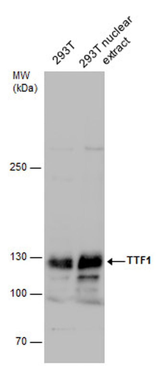 TTF1 Antibody in Western Blot (WB)