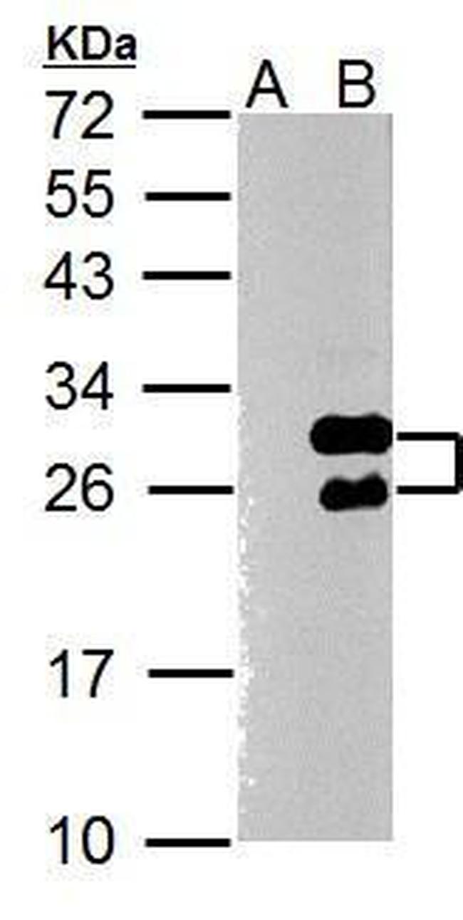 TWIST1 Antibody in Western Blot (WB)