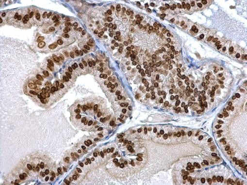 Twist1/Twist2 Antibody in Immunohistochemistry (Paraffin) (IHC (P))