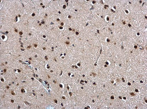 Twist1/Twist2 Antibody in Immunohistochemistry (Paraffin) (IHC (P))