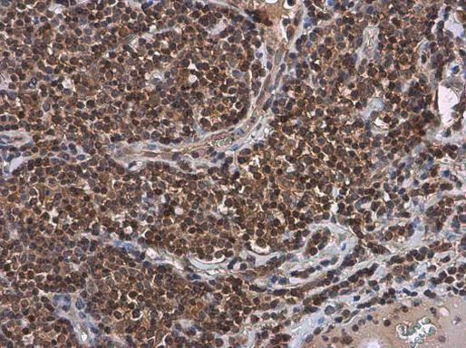 UBC9 Antibody in Immunohistochemistry (Paraffin) (IHC (P))