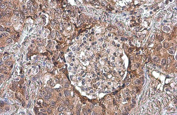 Uteroglobin Antibody in Immunohistochemistry (Paraffin) (IHC (P))