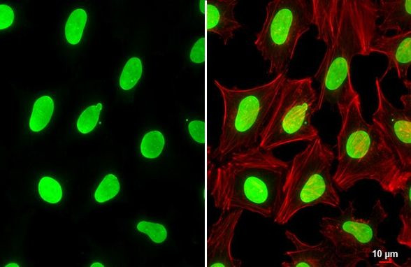 USF2 Antibody in Immunocytochemistry (ICC/IF)