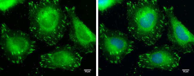 VASP Antibody in Immunocytochemistry (ICC/IF)