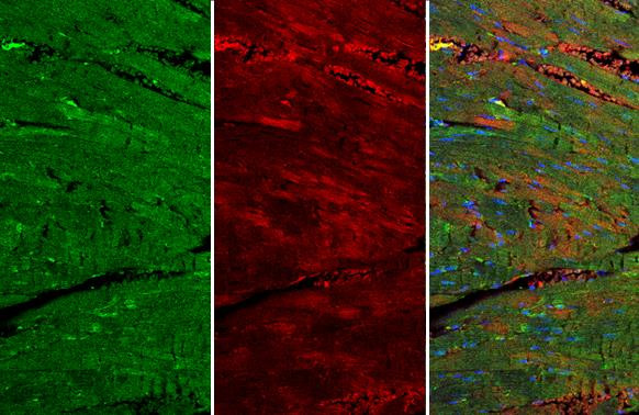 VASP Antibody in Immunohistochemistry (Paraffin) (IHC (P))