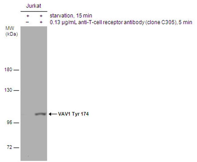 Phospho-VAV1 (Tyr174) Antibody in Western Blot (WB)