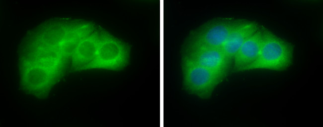 Villin Antibody in Immunocytochemistry (ICC/IF)