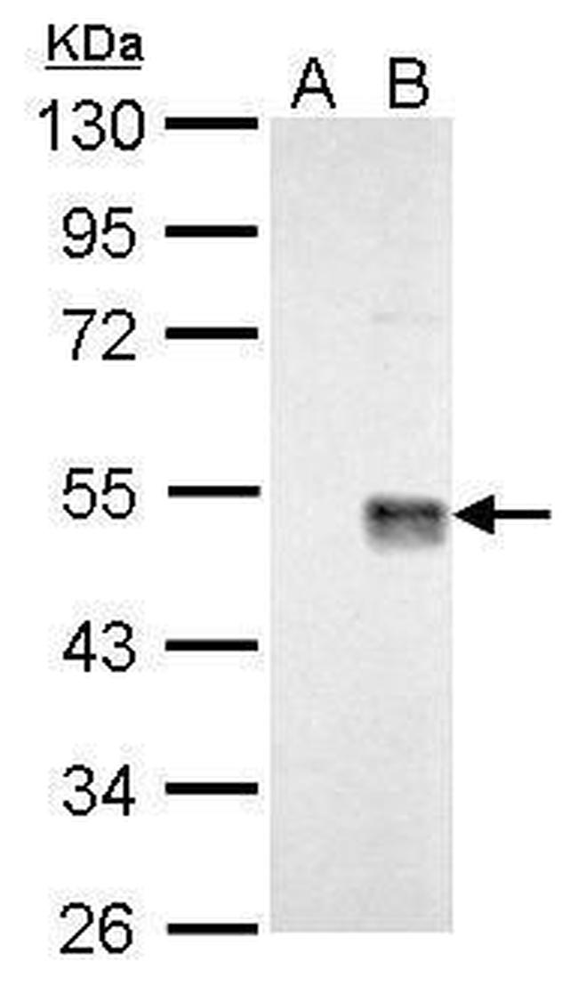 WNT7A Antibody in Western Blot (WB)